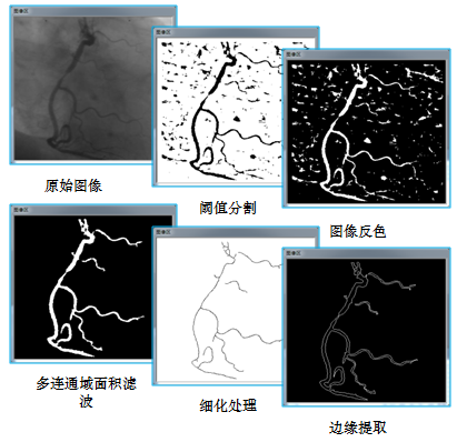 機器視覺-應(yīng)用實例